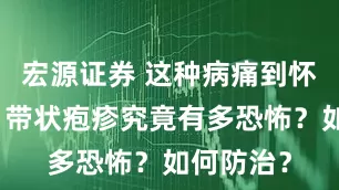 宏源证券 这种病痛到怀疑人生！带状疱疹究竟有多恐怖？如何防治？